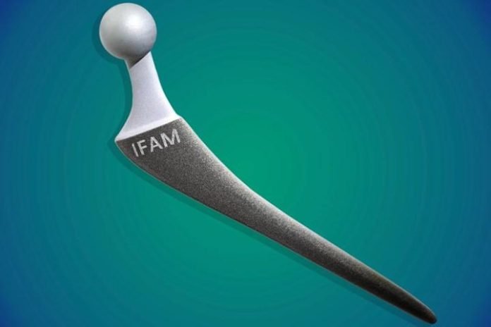 Enfeksiyonları önleyebilecek implant kaplaması geliştirildi